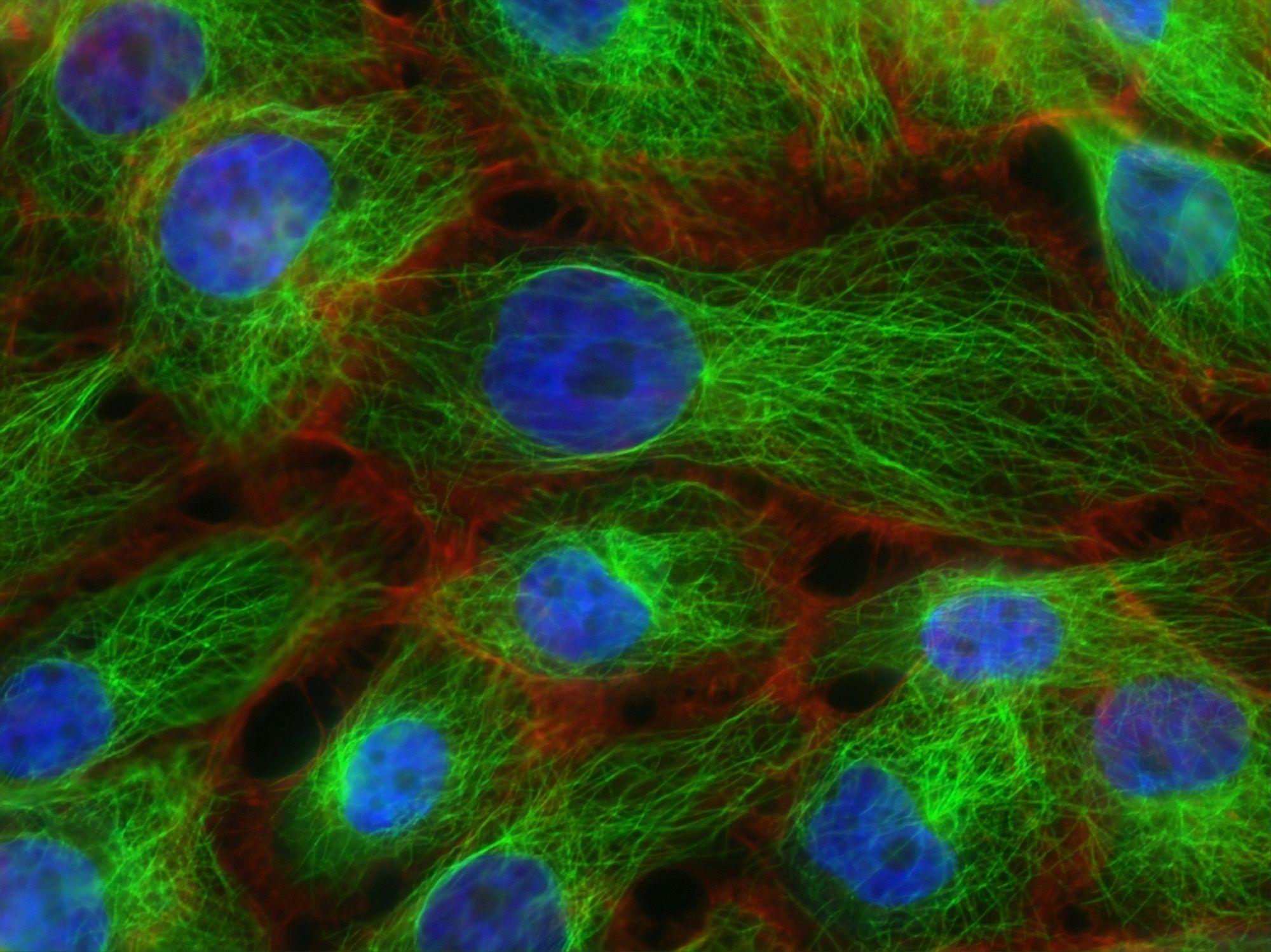 Fluorescence microscopy image of cells stained with AF 488